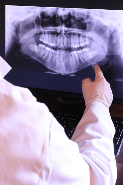 Best Knocked-Out Tooth (Avulsed Tooth) Treatment in Hillsville, VA