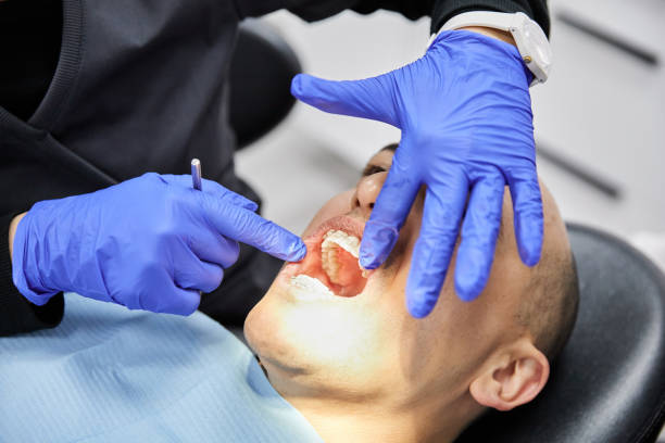 Best Dental Abscess Treatment in Hillsville, VA